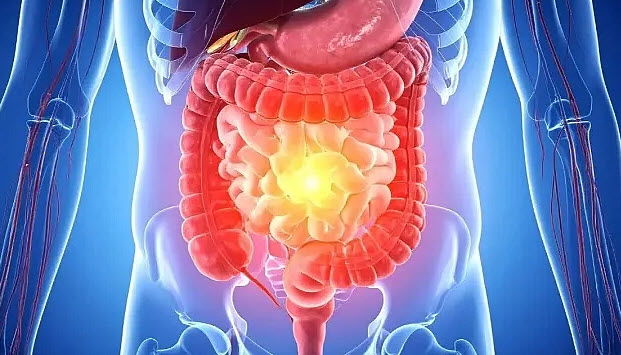 Bağırsak Sağlığı Nedir? Sindirim Sistemini Güçlendiren Alışkanlıklar