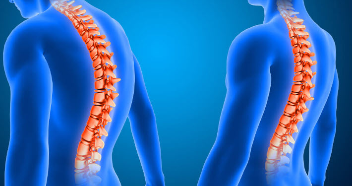 Duruş Bozukluğu Nedir? Evde Yapılabilecek Basit Egzersizler